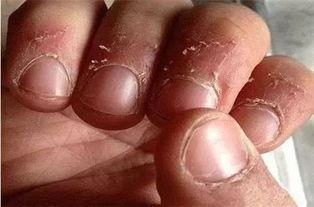 兰陵吃指甲盖的瓜视频,挑战极限的美食冒险